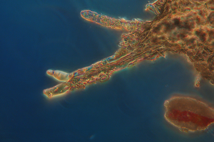 Due croste forse una su abete-foto0555(Hyphoderma setigerum)